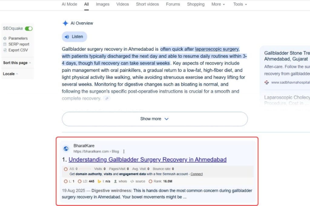 Gallbladder Surgery Recovery in Ahmedabad Keyword Result