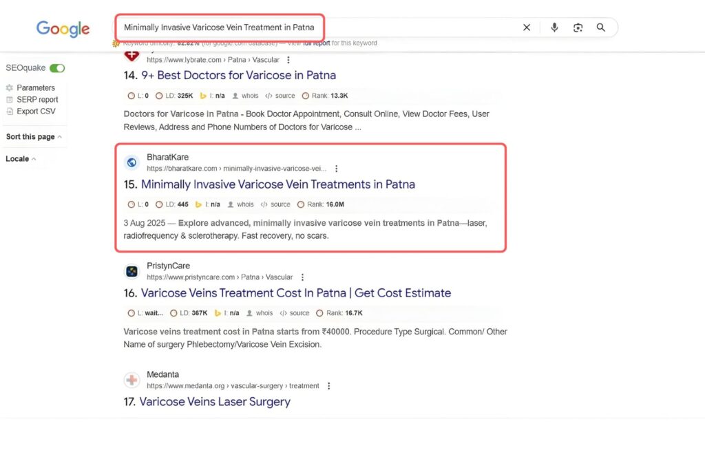 Minimally Invasive Varicose Vein Treatment in Patna Keyword Result