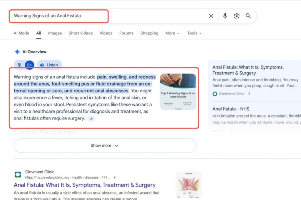 Warning Signs of an Anal Fistula Keyword Result