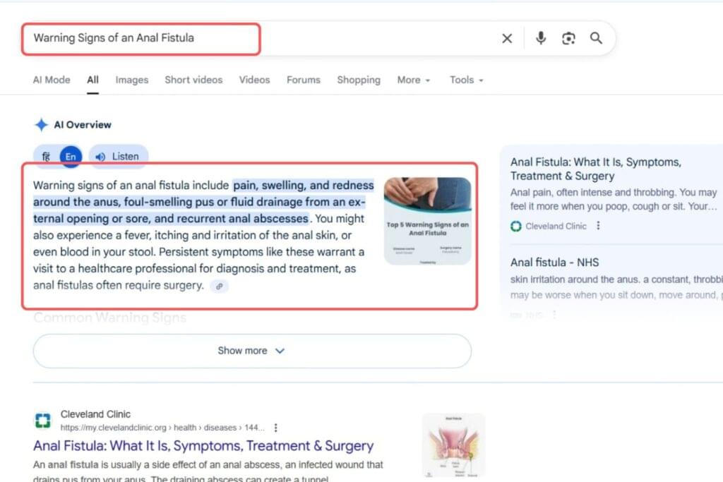 Warning Signs of an Anal Fistula Keyword Result